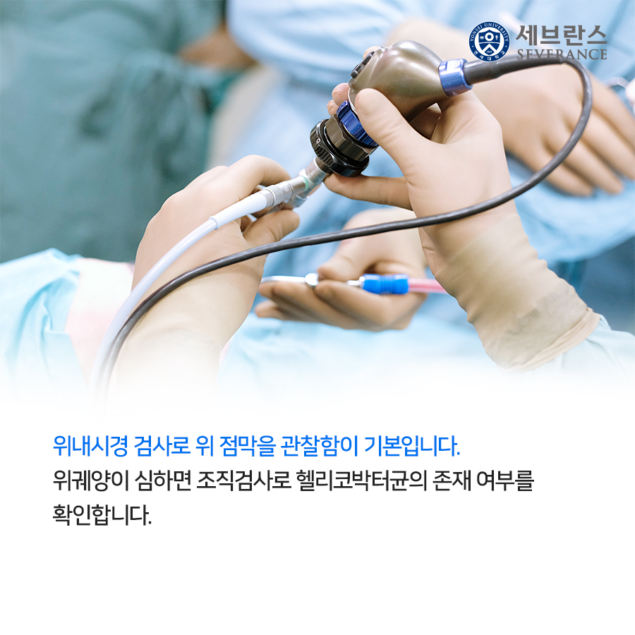 위내시경 검사로 위 점막을 관찰함이 기본입니다. 위궤양이 심하면 조직검사로 헬리코박터균의 존재 여부를 확인합니다.