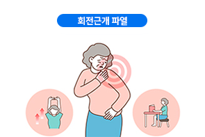 회전근개 파열